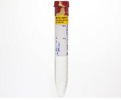 Produkt Vacutainerrör Urinalysis preservative plus Urine Tube